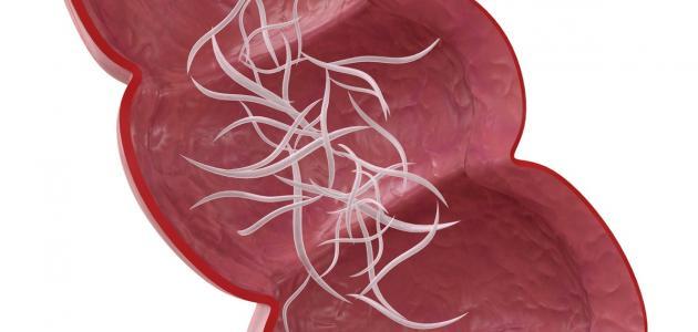 علاج الديدان - طرق بسيطه للتخلص من الديدان نه 326556