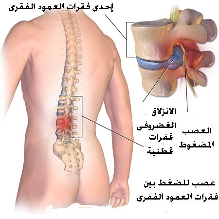 الفقره السابعه في العمود الفقري , تعريف مبسط للعمود الفقري