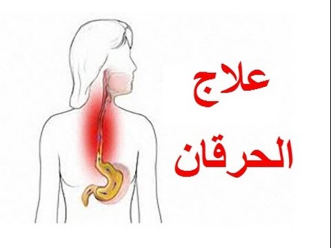 علاج حرقان الزور - التهاب الحلق عند البلع 323069